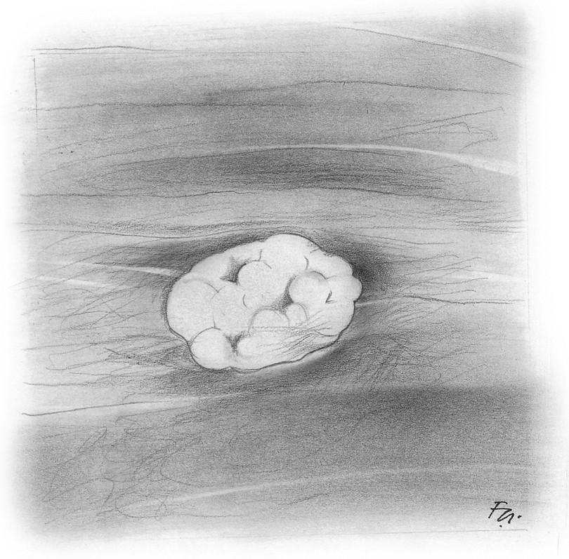 Figure 4-1: Drawing of ultrasound view of a typical fibroadenoma. Note the normal tissue flowing past the lump and the white line under the lump.